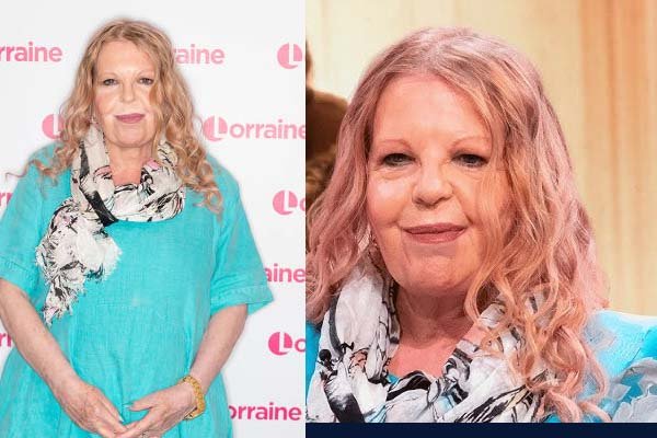Sally Thomsett Face Illness: What Happened and Why